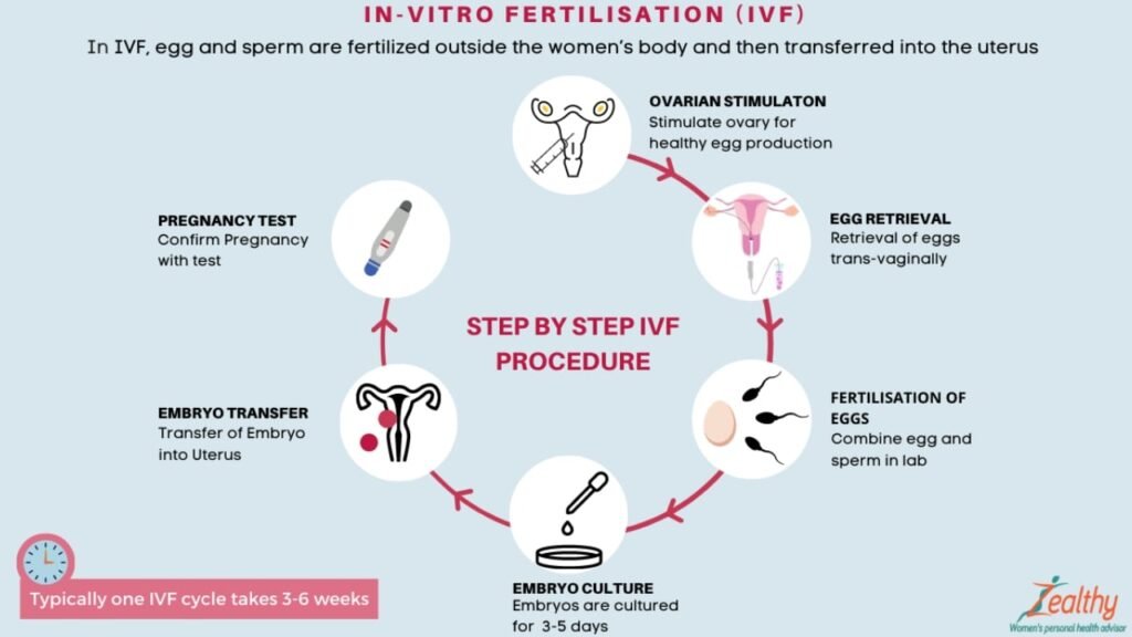 Step-by-step IVF procedure highlighting the prevalence of infertility treatments in India.